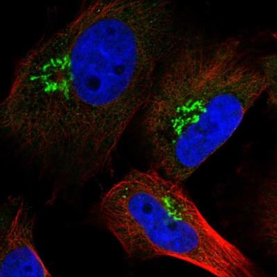 Immunocytochemistry/Immunofluorescence: RNF157 Antibody [NBP1-81360] - Staining of human cell line U-251 MG shows positivity in golgi apparatus.