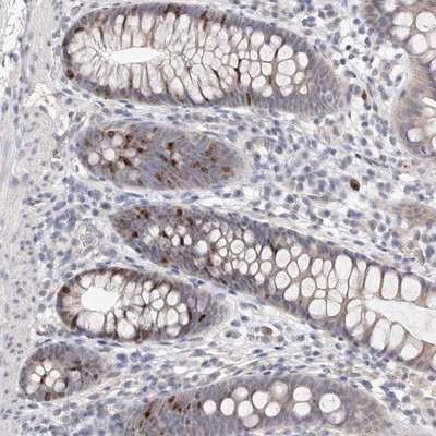 Immunohistochemistry-Paraffin: C1orf110 Antibody [NBP1-82673] - Staining of human colon shows nuclear positivity in a fraction of basal glandular cells.