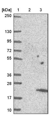 Western Blot: C6orf1 Antibody [NBP1-81323] - Lane 1: Marker [kDa] 250, 130, 95, 72, 55, 36, 28, 17, 10. Lane 2: Negative control (vector only transfected HEK293T lysate). Lane 3: Over-expression lysate (Co-expressed with a C-terminal myc-DDK tag (3.1 kDa) in mammalian HEK293T cells).