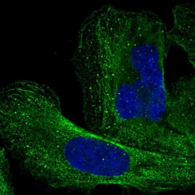 Immunocytochemistry/Immunofluorescence: AGA Antibody [NBP1-88866] - Staining of human cell line U-2 OS shows positivity in vesicles and cytoskeleton (microtubules).