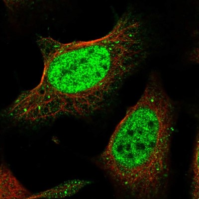 Immunocytochemistry/Immunofluorescence: POGK Antibody [NBP1-88705] - Immunofluorescent staining of human cell line U-2 OS shows localization to nucleoplasm & vesicles.