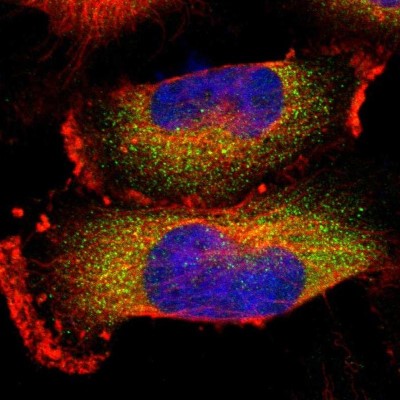 Immunocytochemistry/Immunofluorescence: Stomatin Antibody [NBP1-88562] - Immunofluorescent staining of human cell line U-251 MG shows localization to cytosol.