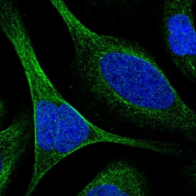 Immunocytochemistry/Immunofluorescence: TCTN3 Antibody [NBP1-88537] - Immunofluorescent staining of human cell line U-2 OS shows localization to microtubules.
