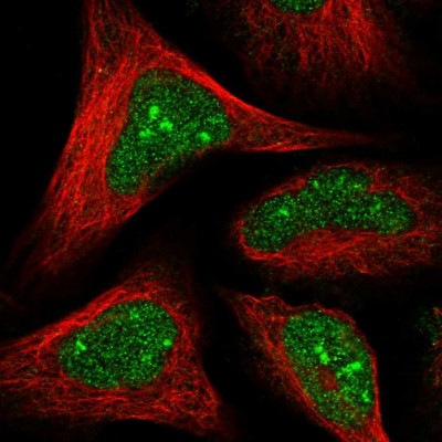 Immunocytochemistry/Immunofluorescence: HD domain containing 2 Antibody [NBP1-88251] - Immunofluorescent staining of human cell line U-2 OS shows localization to nucleus & nucleoli.