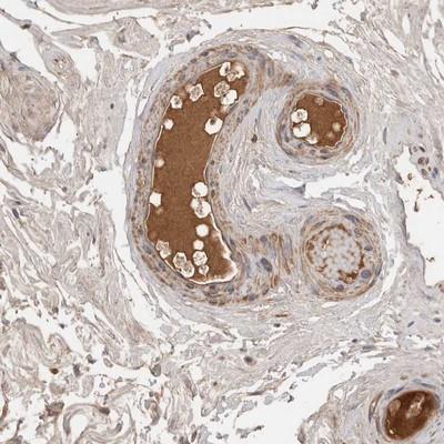 Immunohistochemistry-Paraffin: Complement Factor I Antibody [NBP1-88267] -  Staining of human epididymis shows distinct positivity in plasma.