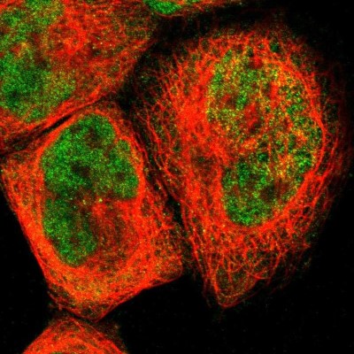 Immunocytochemistry/Immunofluorescence: LRFN5 Antibody [NBP1-88412] - Staining of human cell line A-431 shows positivity in nucleus but not nucleoli.