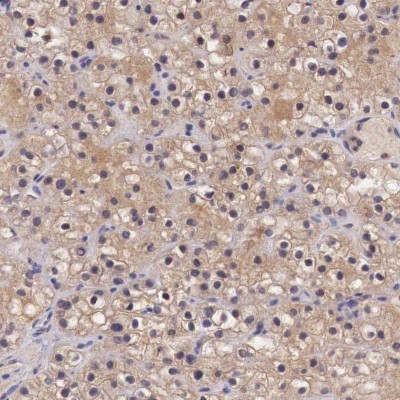 Immunohistochemistry-Paraffin: Chordin-like 1/CHRDL1 Antibody [NBP1-84486] - Staining of human parathyroid gland shows cytoplasmic positivity in glandular cells.