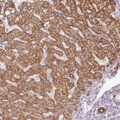 Immunohistochemistry-Paraffin: C3orf55 Antibody [NBP2-14781] - Staining of human liver shows strong cytoplasmic positivity in hepatocytes and bile duct cells.