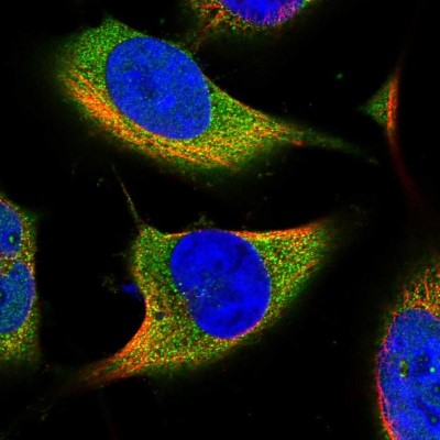 Immunocytochemistry/Immunofluorescence: ACSBG2 Antibody [NBP1-88642] - Immunofluorescent staining of human cell line U-251 MG shows localization to cytosol.