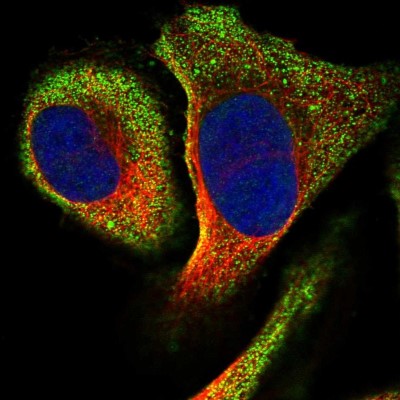 Immunocytochemistry/Immunofluorescence: RSAD1 Antibody [NBP1-83772] - Immunofluorescent staining of human cell line U-2 OS shows localization to cytosol.
