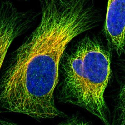 Immunocytochemistry/Immunofluorescence: EPS15R Antibody [NBP1-84828] - Staining of human cell line U-2 OS shows positivity in cytoskeleton (microtubules).