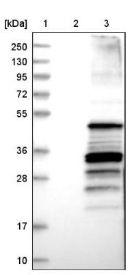 Western Blot: CC Chemokine Receptor D6 Antibody [NBP1-88150] - Lane 1: Marker [kDa] 250, 130, 95, 72, 55, 36, 28, 17, 10. Lane 2: Negative control (vector only transfected HEK293T lysate). Lane 3: Over-expression lysate (Co-expressed with a C-terminal myc-DDK tag (3.1 kDa) in mammalian HEK293T cells).