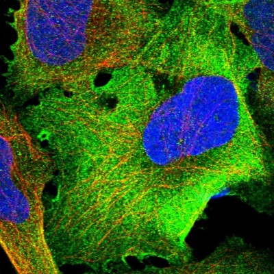 Immunocytochemistry/Immunofluorescence: TRMT1 Antibody [NBP1-82197] - Staining of human cell line U-2 OS shows positivity in plasma membrane and cytoplasm.