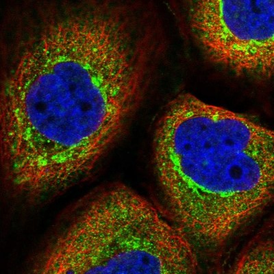 Immunocytochemistry/Immunofluorescence: TMCO7 Antibody [NBP1-82286] - Immunofluorescent staining of human cell line A-431 shows localization to cytosol & the Golgi apparatus.