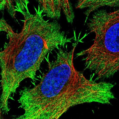 Immunocytochemistry/Immunofluorescence: PITPNM3 Antibody [NBP2-33894] - Staining of human cell line HeLa shows localization to plasma membrane.