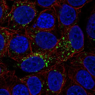 Immunocytochemistry/Immunofluorescence: VGF Antibody [NBP2-31596] - Immunofluorescent staining of human cell line MCF7 shows localization to vesicles.