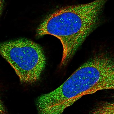 Immunocytochemistry/Immunofluorescence: FAM216B Antibody [NBP1-83448] - Staining of human cell line U-2 OS shows positivity in nucleoli and cytoplasm.