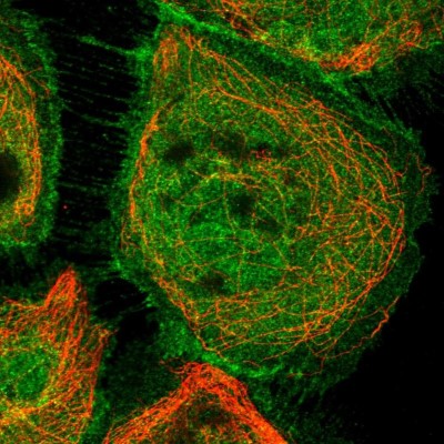 Immunocytochemistry/Immunofluorescence: TRAFD1 Antibody [NBP1-81874] - Staining of human cell line A-431 shows positivity in nuclear membrane and plasma membrane.