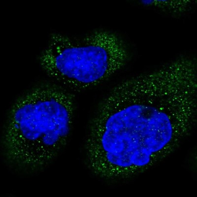Immunocytochemistry/Immunofluorescence: MB21D2 Antibody [NBP1-92101] - Immunofluorescent staining of human cell line A-431 shows localization to cytosol.
