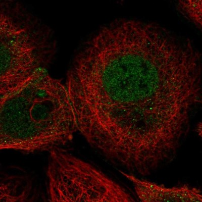 Immunocytochemistry/Immunofluorescence: NHA2/SLC9B2/NHEDC2 Antibody [NBP2-13348] - Immunofluorescent staining of human cell line A-431 shows localization to nucleoplasm & cell junctions.