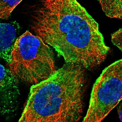 Immunocytochemistry/Immunofluorescence: JMJD4 Antibody [NBP1-94032] - Immunofluorescent staining of human cell line A-431 shows localization to plasma membrane & vesicles.