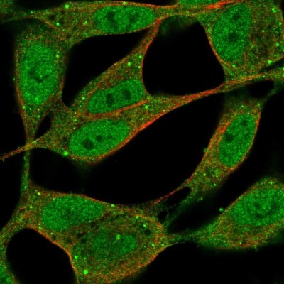 Immunocytochemistry/Immunofluorescence: ZFPM1 Antibody [NBP2-47572] - Immunofluorescent staining of human cell line SH-SY5Y shows localization to nucleoplasm, cytosol & vesicles.