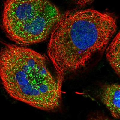 Immunocytochemistry/Immunofluorescence: ZFYVE16 Antibody [NBP1-81516] - Immunofluorescent staining of human cell line A-431 shows localization to cytosol & vesicles.