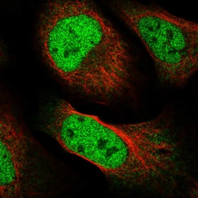 Immunocytochemistry/Immunofluorescence: FAM59A Antibody [NBP2-47460] - Immunofluorescent staining of human cell line U-2 OS shows localization to nucleoplasm & cytosol.