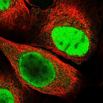 Immunocytochemistry/Immunofluorescence: HDGF2 Antibody [NBP2-47437] - Immunofluorescent staining of human cell line A-431 shows localization to nucleoplasm.