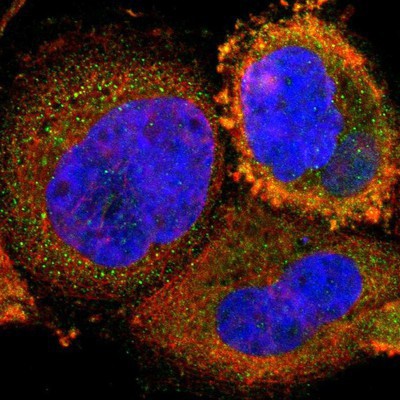 Immunocytochemistry/Immunofluorescence: HBXIP Antibody [NBP1-82664] Staining of human cell line A-431 shows positivity in cytoplasm.