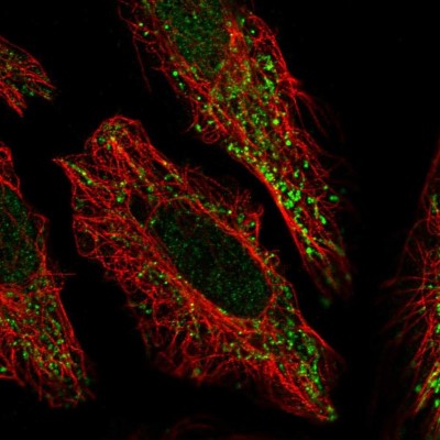 Immunocytochemistry/Immunofluorescence: PCMTD2 Antibody [NBP2-31698] - Immunofluorescent staining of human cell line HeLa shows localization to nucleoplasm & mitochondria.