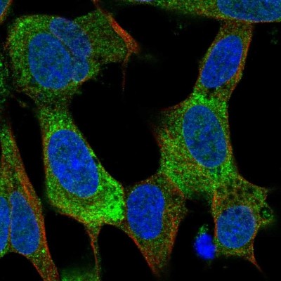 Immunocytochemistry/Immunofluorescence: Kv7.2 Antibody [NBP2-38820] - Immunofluorescent staining of human cell line SH-SY5Y shows localization to endoplasmic reticulum.