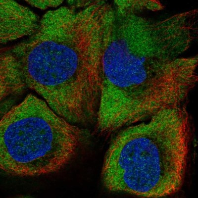 Immunocytochemistry/Immunofluorescence: PADI1 Antibody [NBP2-37761] - Staining of human cell line HaCaT shows localization to cytosol.