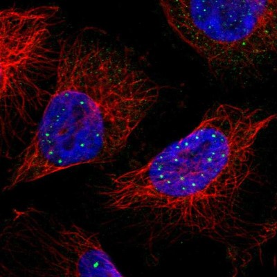 Immunocytochemistry/Immunofluorescence: TIP120B Antibody [NBP2-33858] - Immunofluorescent staining of human cell line U-251 MG shows localization to nuclear bodies.