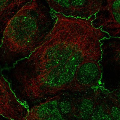 Immunocytochemistry/Immunofluorescence: Frizzled-2 Antibody [NBP2-33842] - Immunofluorescent staining of human cell line CACO-2 shows localization to nuclear bodies & cell junctions.