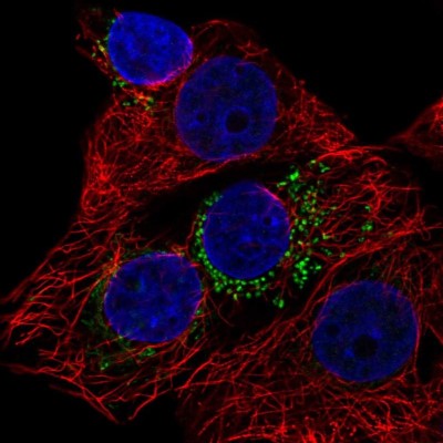 Immunocytochemistry/Immunofluorescence: DYRK4 Antibody [NBP2-38781] - Immunofluorescent staining of human cell line MCF7 shows localization to vesicles.