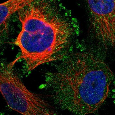 Immunocytochemistry/Immunofluorescence: Kv9.3 Antibody [NBP1-81334] - Immunofluorescent staining of human cell line U-251 MG shows localization to plasma membrane & cytosol.