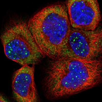 Immunocytochemistry/Immunofluorescence: RPL4 Antibody [NBP1-81329] - Staining of human cell line A-431 shows localization to nuclear bodies, cytosol & endoplasmic reticulum.
