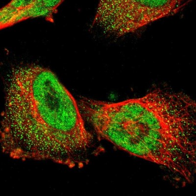 Immunocytochemistry/Immunofluorescence: P11 Antibody [NBP1-82458] - Staining of human cell line U-251MG shows positivity in nucleus but not nucleoli and cytoplasm.
