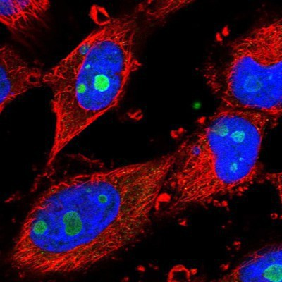 Immunocytochemistry/Immunofluorescence: BXDC1 Antibody [NBP1-90031] - Staining of human cell line U-251 MG shows positivity in nucleus and nucleoli.