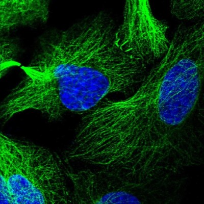Immunocytochemistry/Immunofluorescence: LRRC34 Antibody [NBP1-81146] - Immunofluorescent staining of human cell line U-2 OS shows localization to microtubules, cytokinetic bridge & cell junctions.