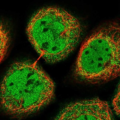 Immunocytochemistry/Immunofluorescence: ST7/LRP12 Antibody [NBP1-84772] - Staining of human cell line A-431 shows localization to nucleoplasm & cytosol.