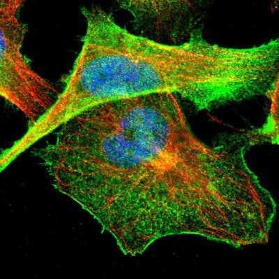 Immunocytochemistry/Immunofluorescence: NHERF-2 Antibody [NBP1-84944] - Staining of human cell line U-251MG shows positivity in plasma membrane.