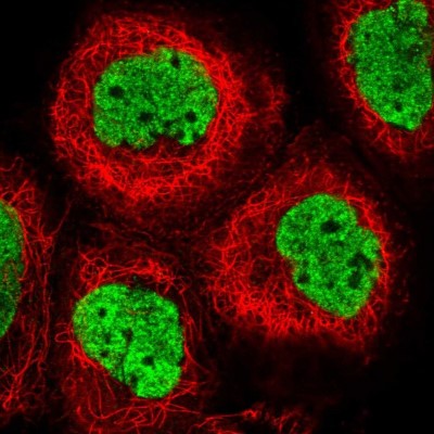 Immunocytochemistry/Immunofluorescence: RAVER2 Antibody [NBP1-92319] - Staining of human cell line A-431 shows positivity in nucleus but not nucleoli.