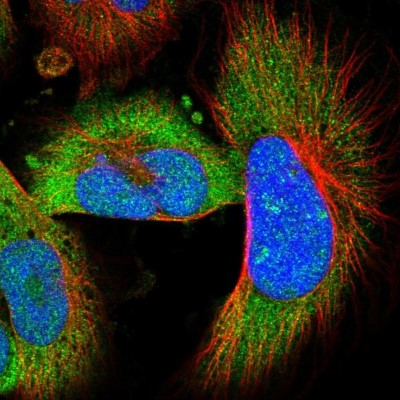 Immunocytochemistry/Immunofluorescence: Adenylate Cyclase 8 Antibody [NBP1-90278] - Staining of human cell line U-251MG shows positivity in nucleus, nucleoli and cytoplasm.