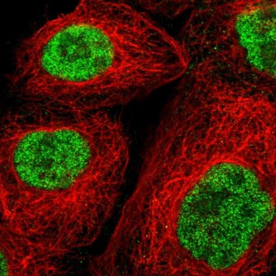 Immunocytochemistry/Immunofluorescence: Sperm-associated antigen 7 Antibody [NBP1-90261] - Immunofluorescent staining of human cell line A-431 shows localization to nucleoplasm.