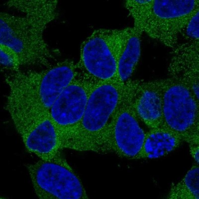 Immunocytochemistry/Immunofluorescence: KIF21A Antibody [NBP2-37969] - Staining of human cell line SH-SY5Y shows localization to plasma membrane & cytosol.