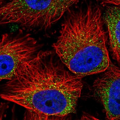 Immunocytochemistry/Immunofluorescence: MIA3 Antibody [NBP2-34160] - Immunofluorescent staining of human cell line U-251 MG shows localization to vesicles.