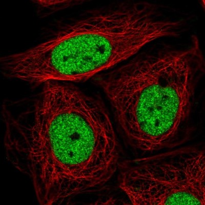 Immunocytochemistry/Immunofluorescence: SIN3A Antibody [NBP2-38949] - Immunofluorescent staining of human cell line SiHa shows localization to nucleoplasm.