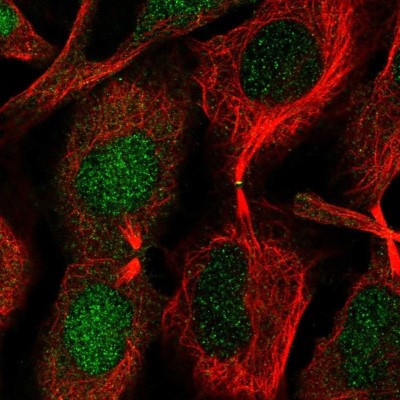Immunocytochemistry/Immunofluorescence: CHMP1B Antibody [NBP2-37986] - Staining of human cell line U-2 OS shows localization to nucleus & midbody.